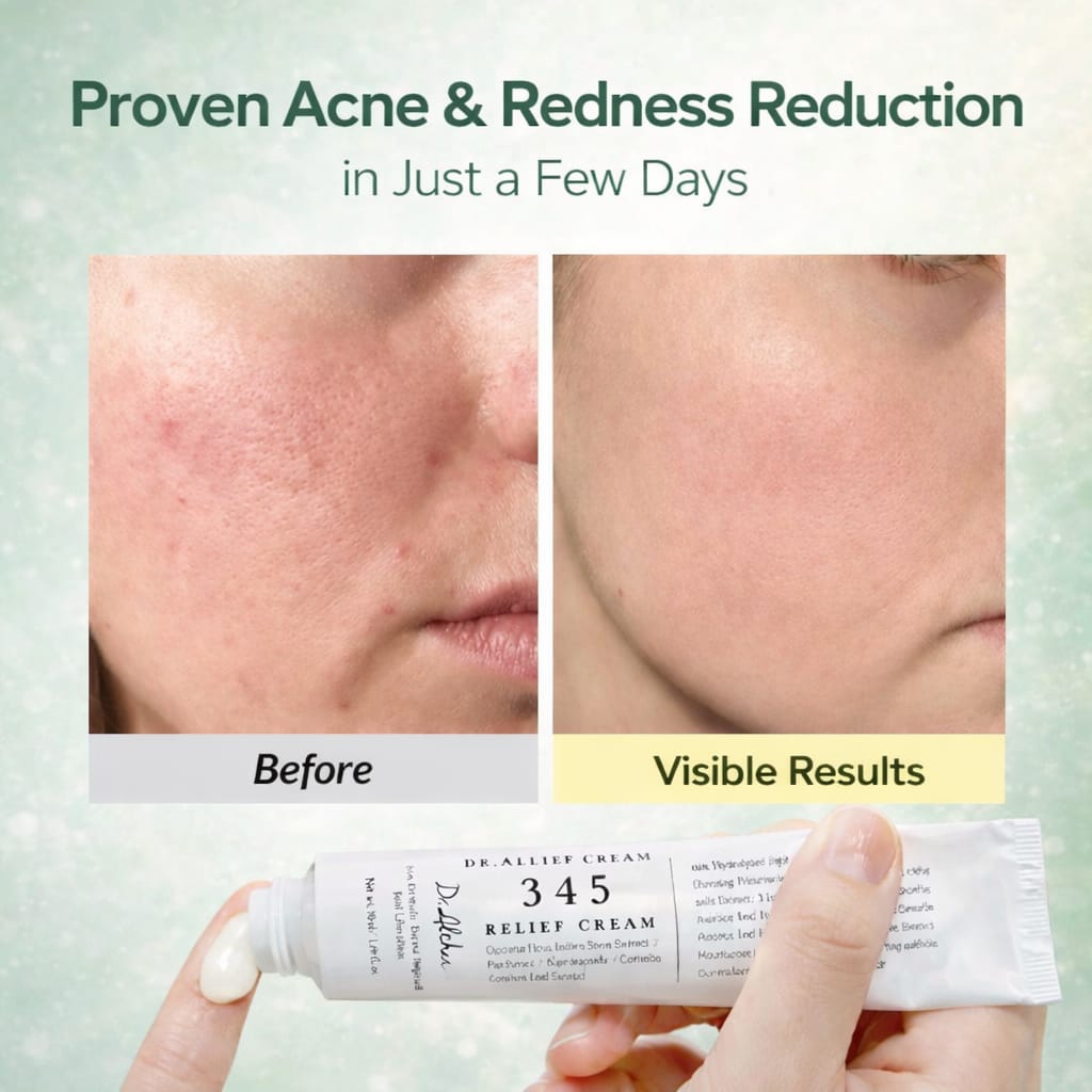 345 Relief Cream – Skin Barrier Repair Cream for Acne & Sensitive Skin